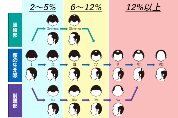 ミノクソール（外用薬）の選び方