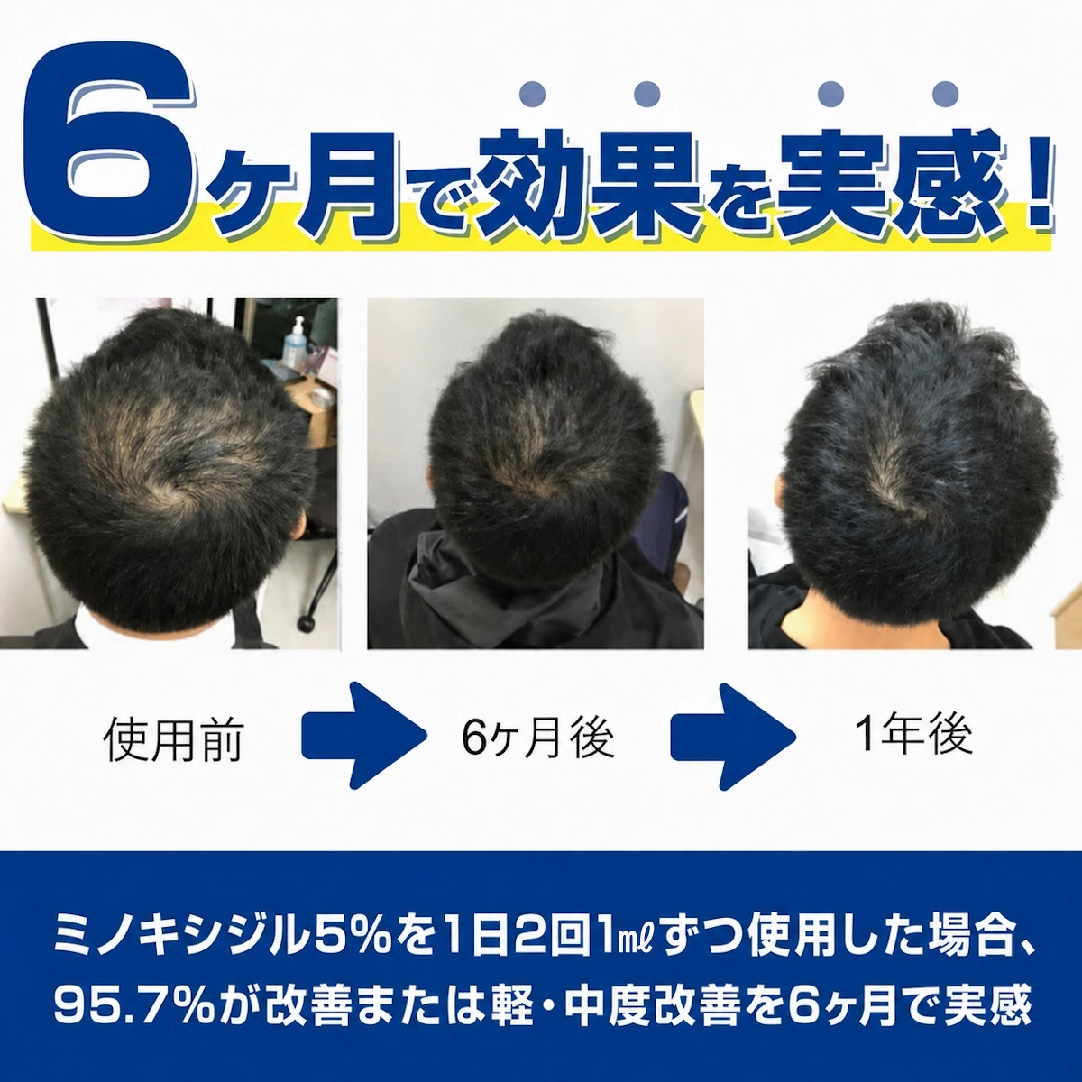 フォリックスFR12 効果を実感するまでの期間