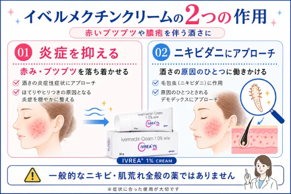 イベルメクチンクリームの効果