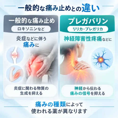 プレガバリンと一般的な痛み止めの違い
