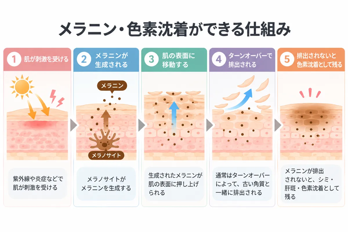 メラニン・色素沈着ができる仕組み