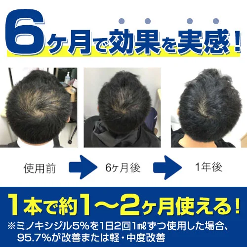フォリックスFR12